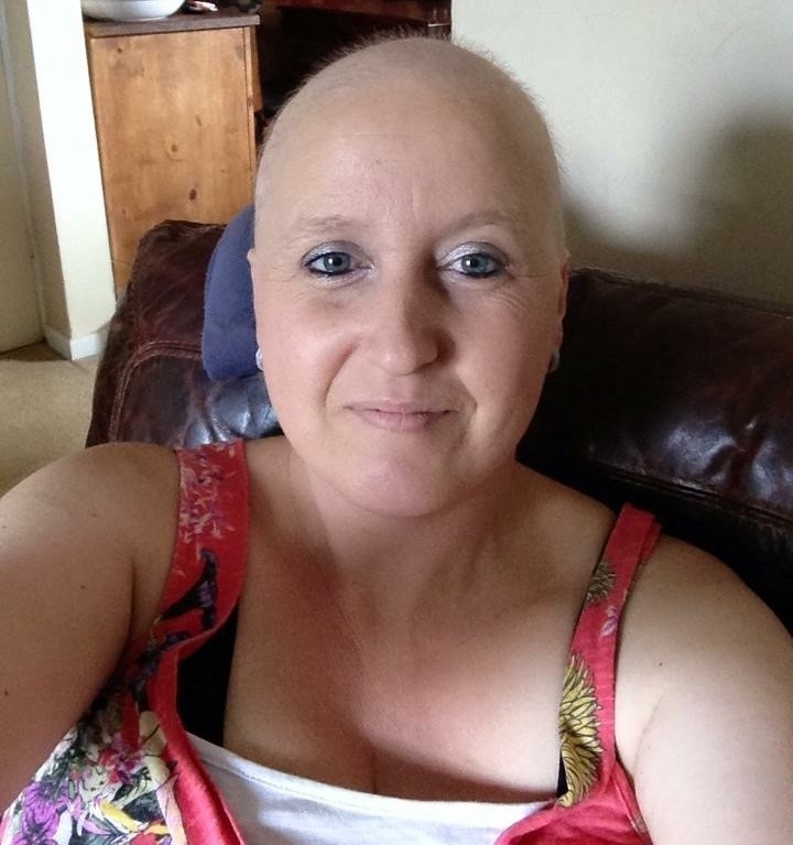Sarah lost her hair following her chemotherapy treatment in 2014. Photo: Macmillan